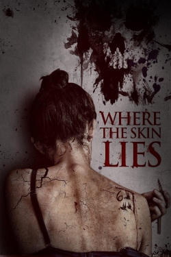 Watch Where the Skin Lies Online Free and No Sign Up - 285 HDMovie